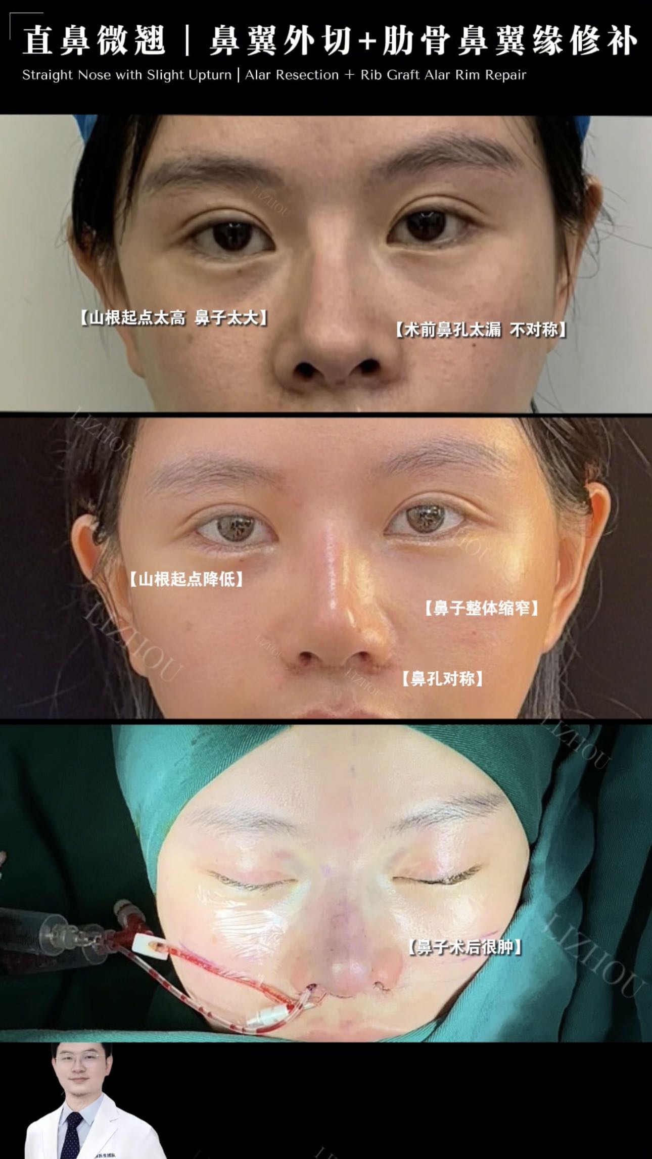 Case 11