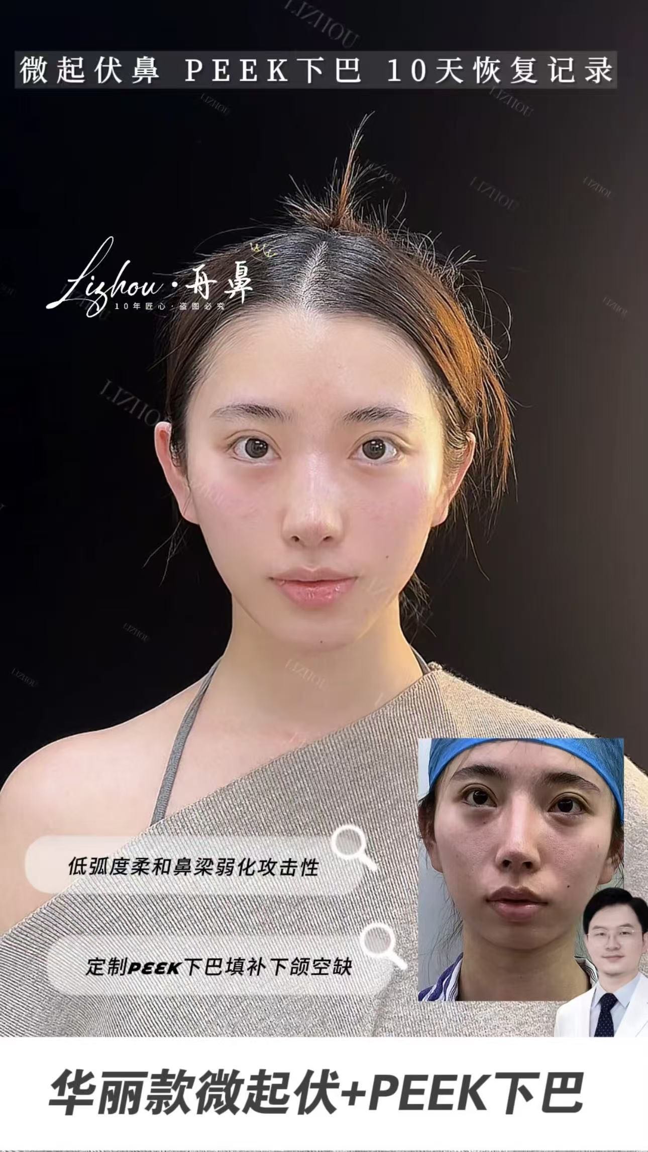 Case 04