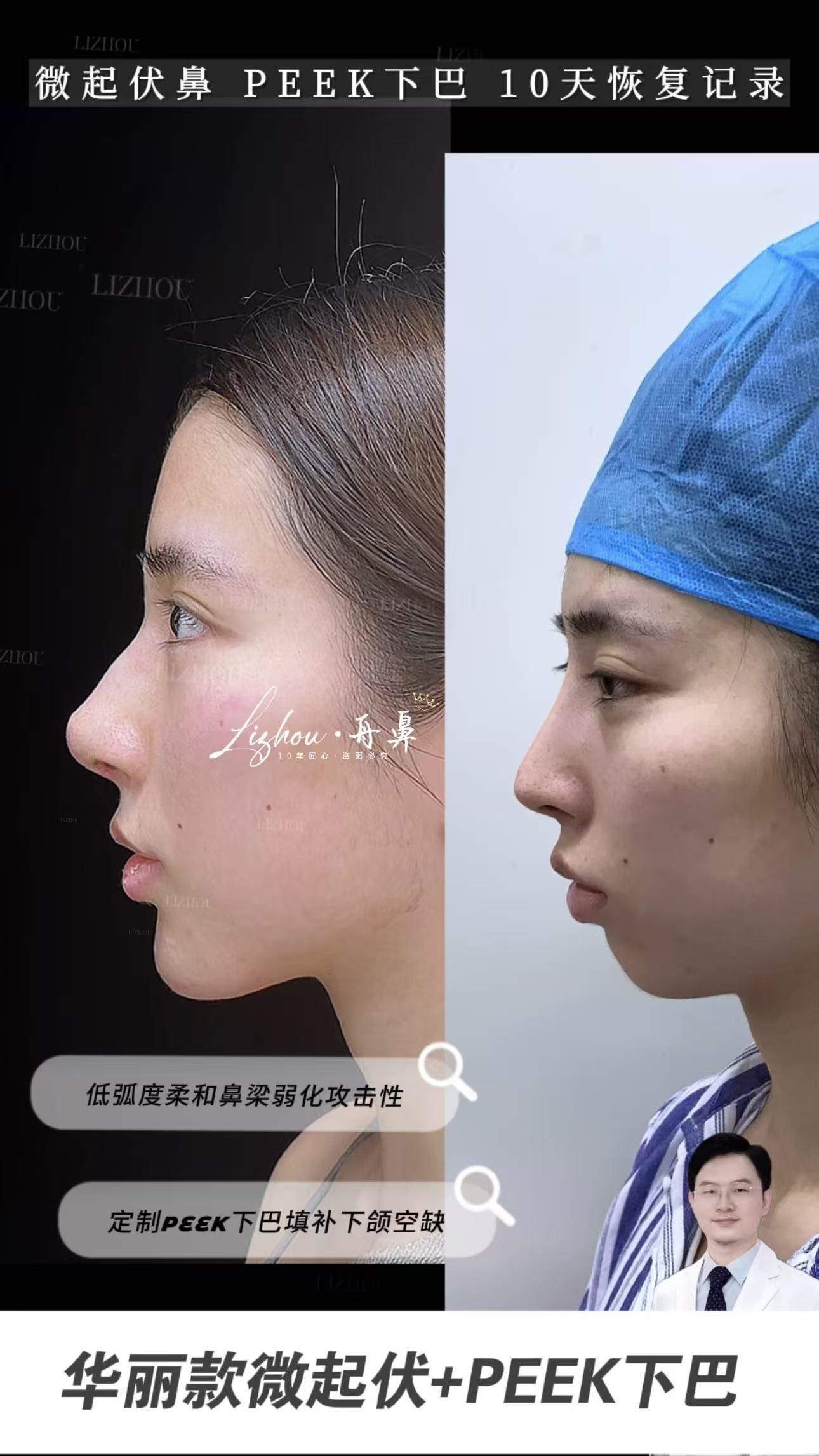 Case 08